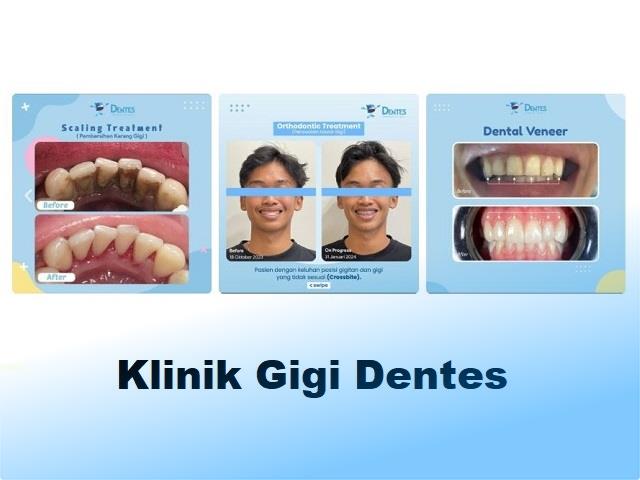 klinik gigi dentes purwokerto