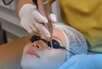 Ella Skincare Magelang